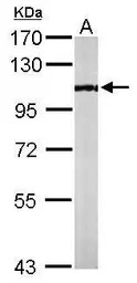 PCAF antibody [C3], C-term