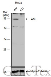 ASL antibody