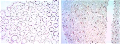 Bcl-2 antibody [8E12]