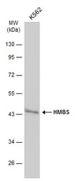 HMBS antibody [N2C3]
