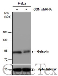 Gelsolin antibody