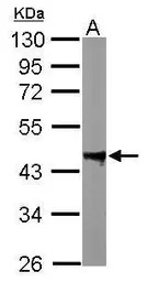 PPM1A antibody