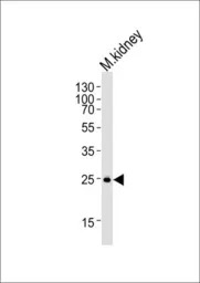 SNAI1 antibody, N-term