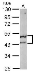 ST3GAL5 antibody [N3C3]