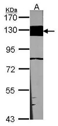 Laminin beta 3 antibody [C1C2]