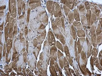 PUS1 antibody [N2C3]