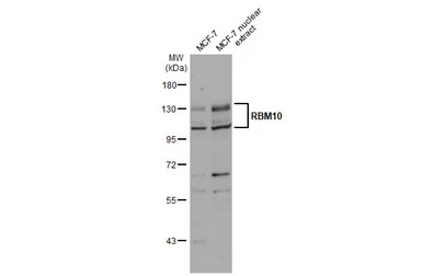 RBM10 antibody