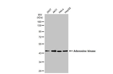 Adenosine kinase antibody
