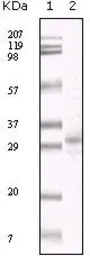 KSHV ORF26 antibody [2F6B8]