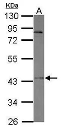OTUD5 antibody [C1C3]