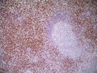 CD8 alpha antibody [YTS105.18]