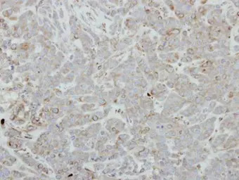 FBLIM1 antibody [N3C3]
