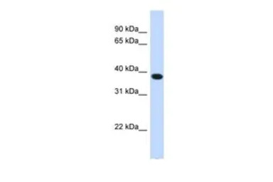 ACBD4 antibody, N-term