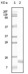 gamma Synuclein antibody [1H10