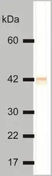 Cytokeratin 18 antibody [DC-10