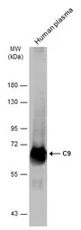 C9 antibody [N2C2-2], Internal
