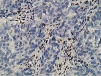 ZIM2 antibody [5E12]