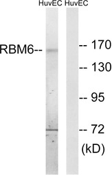 RBM6 antibody