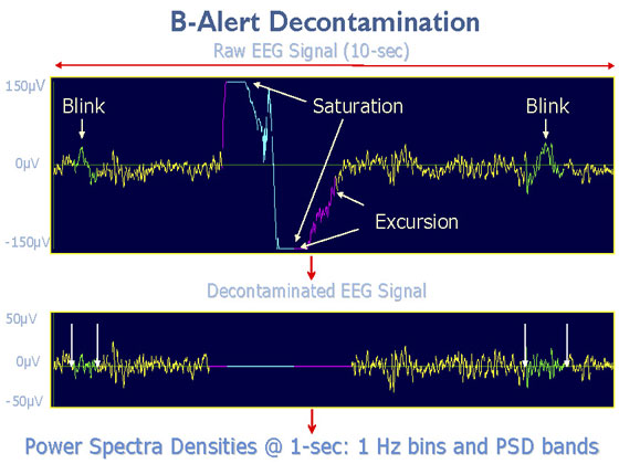 B-Alert EEG Decontamination