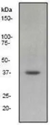 MEK6 antibody [EP558Y], C-term
