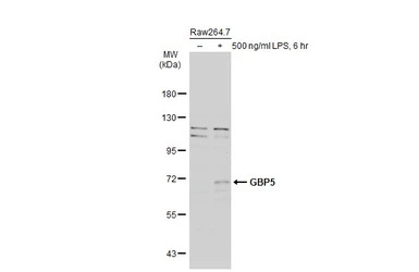 GBP5 antibody [N1N3]