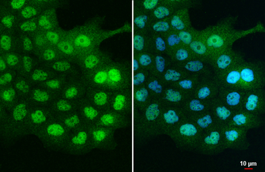 C21orf2 antibody [N1C2]