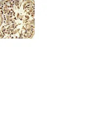 TRP2 antibody, N-term