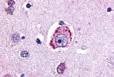 MC4 Receptor antibody