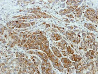 ISCU antibody [N1C3]