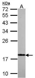 Visinin-like 1 antibody