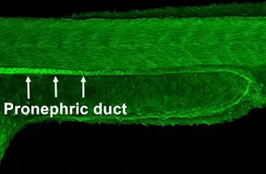 alpha Adducin antibody
