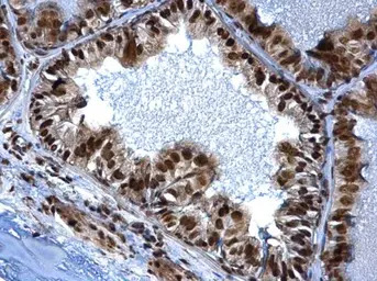 SMARCC1 antibody [C2C3], C-ter