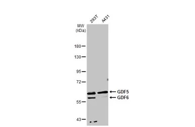 GDF5 + GDF6 antibody [C3], C-t