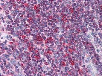 LYRIC antibody [2F11C3]