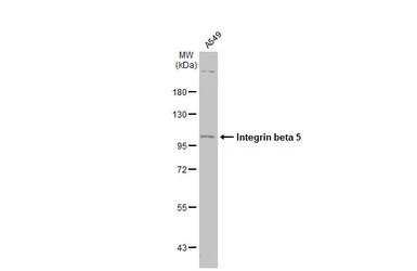 Integrin beta 5 antibody [N1C1