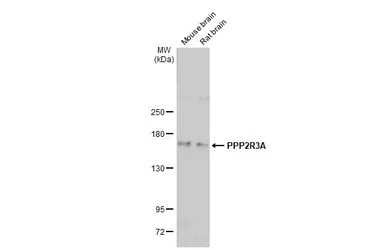 PPP2R3A antibody [C2C3], C-ter