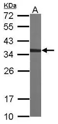 CAPZA2 antibody [N2C3]