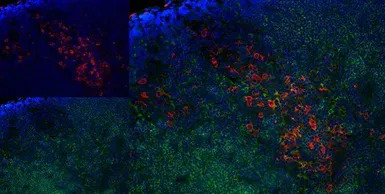 CD163 antibody [ED2]