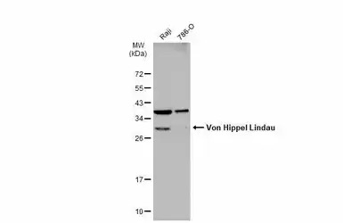 Von Hippel Lindau antibody