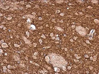 Tyrosine Hydroxylase antibody