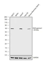 Retinoic Acid Receptor gamma a