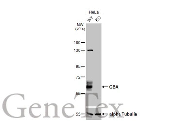 GBA antibody