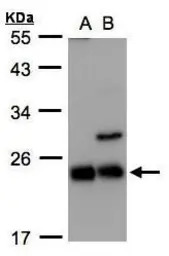 CBFb antibody [N1C3]