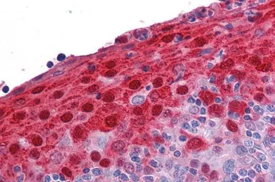 Psoriasin antibody, Internal