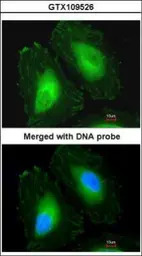 beta A4 Crystallin antibody [N
