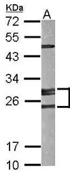 Adenylate kinase 2 antibody [N