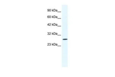 CLIC1 antibody, N-term