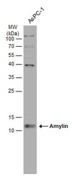 Amylin antibody [N2C3]