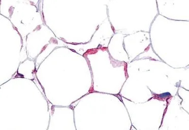 VIP receptor 1 antibody