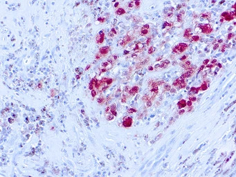 S100 antibody [SH-B1] (ready-t